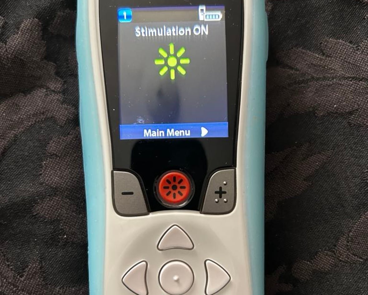 A small white remote that says "Sttimulation ON."
