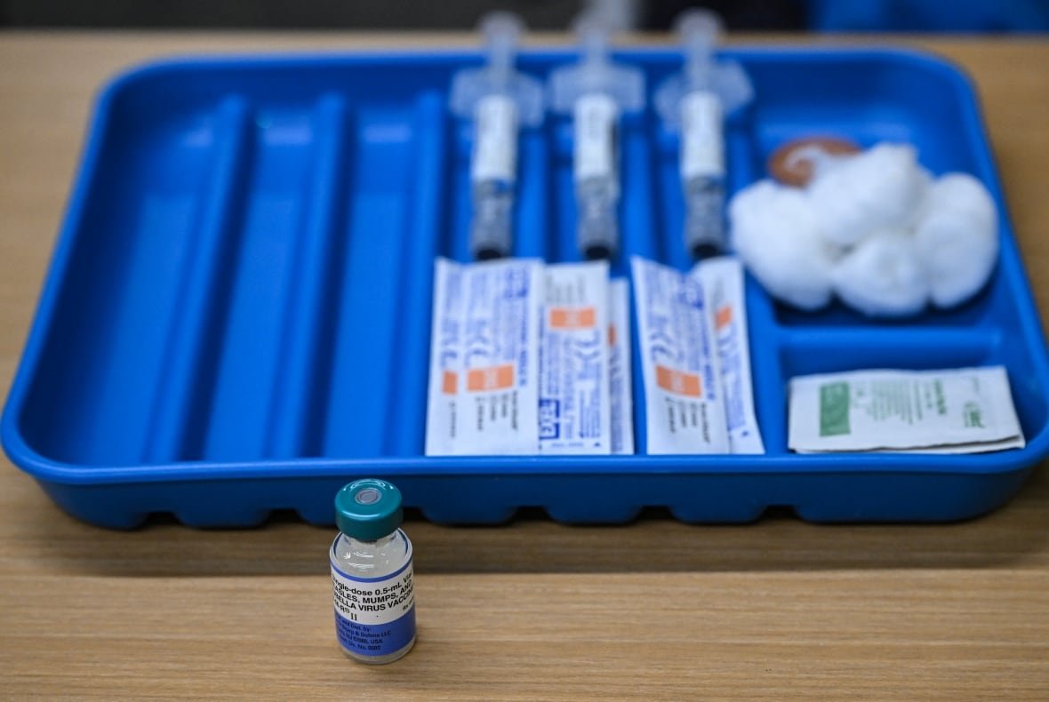 A dose of the measles vaccine is seen on a table with vaccination supplies.
