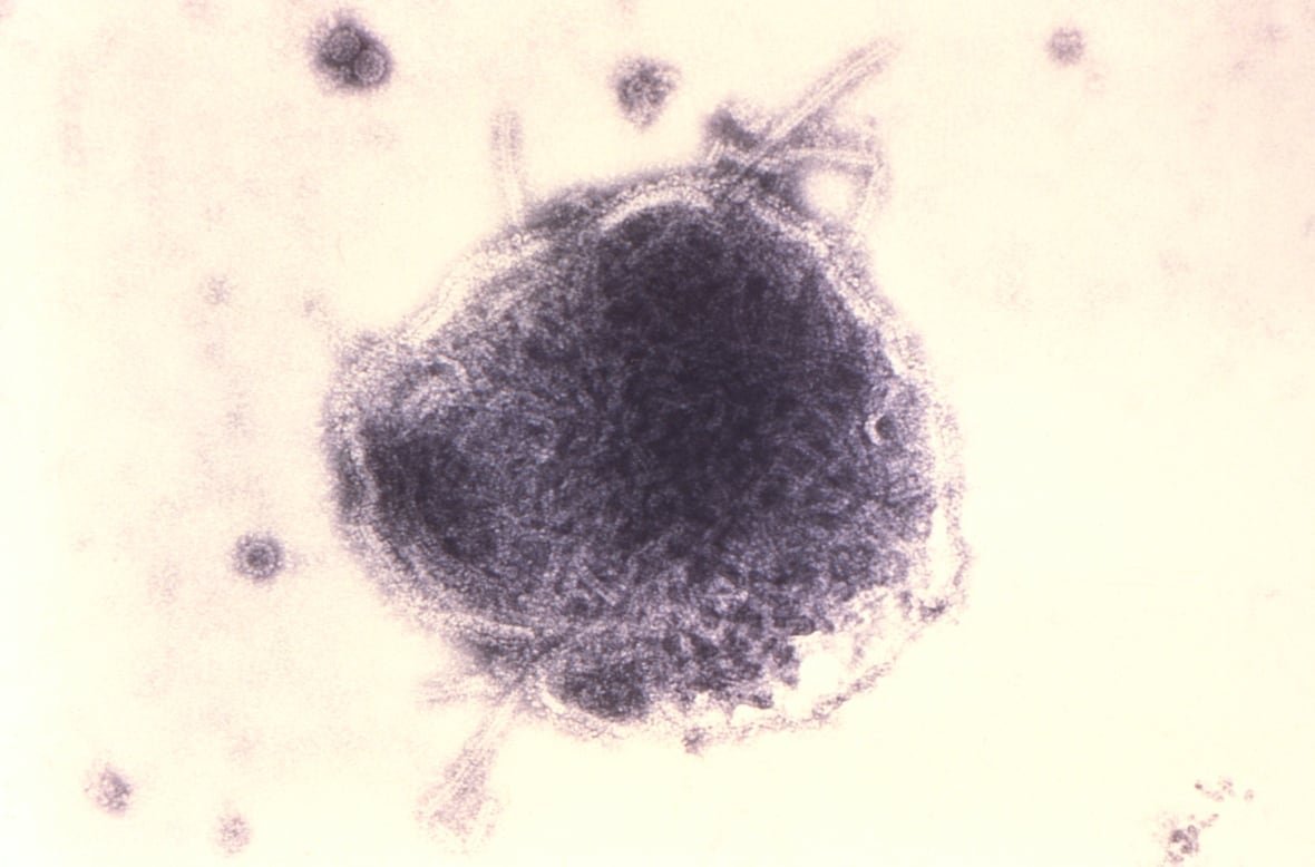 A paramyxovirus measles virus seen in a transmission electron micrographic image