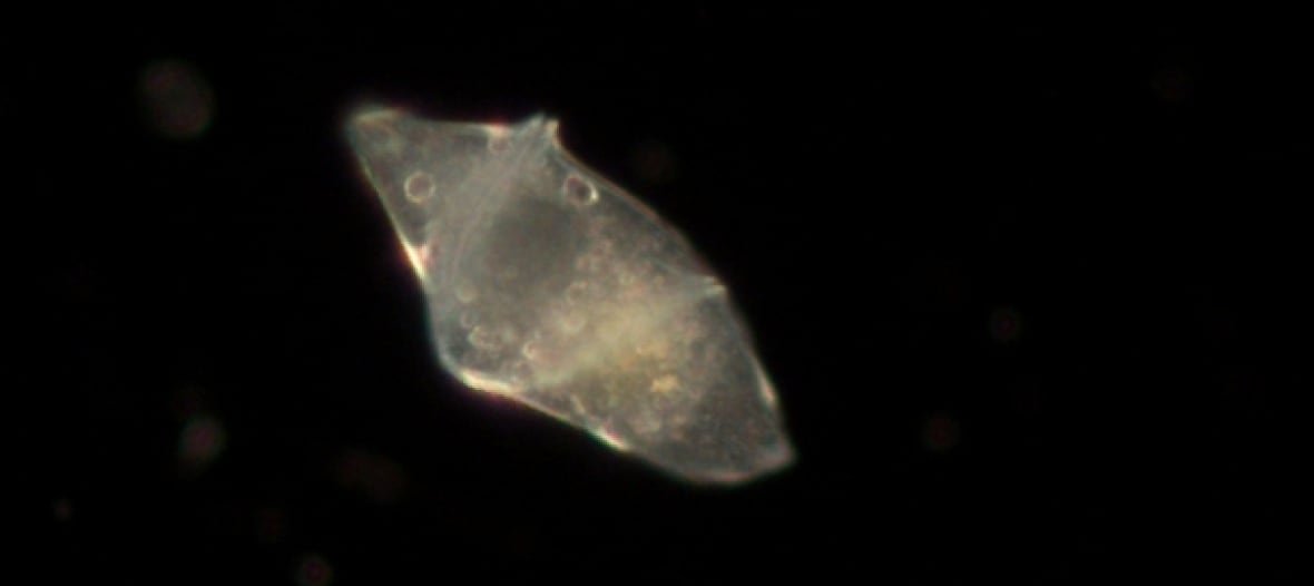 A microscope's photo shows a translucent blob pictured against a black background.