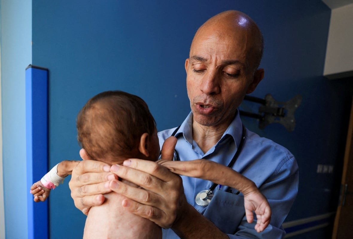 A man wearing a blue dress shirt and a stethoscope holds up a baby with incredibly thin arms.