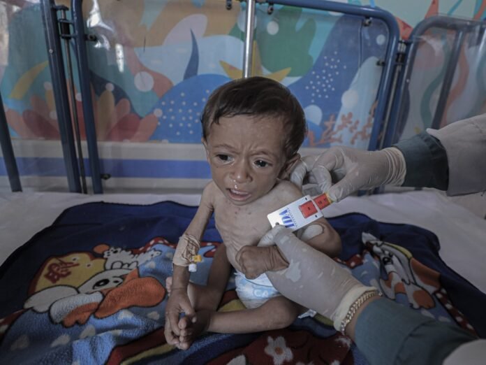 Israel Starving Gaza: 263 Dead From Starvation, Including 112 Children - Dubai News TV