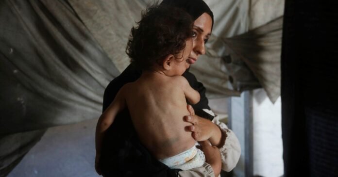Israel’s Starvation Denial Is An Orwellian Farce - Dubai News TV