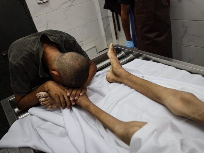 Palestinian Boy, 17, Dies Of Israel-induced Starvation In Gaza - Dubai News TV