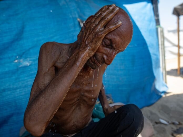 What ‘starvation’ Really Means, For The Human Body And For Gaza - Dubai News TV